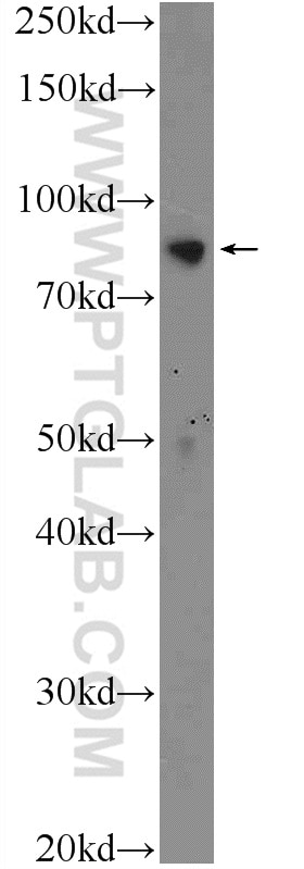 Western Blot (WB) analysis of Jurkat cells using XRCC1 Polyclonal antibody (21468-1-AP)