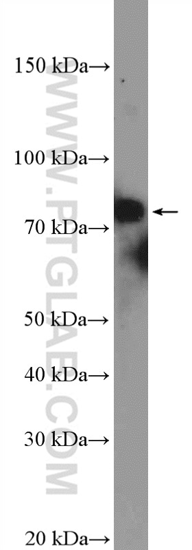 Western Blot (WB) analysis of HeLa cells using XRCC1 Polyclonal antibody (21468-1-AP)