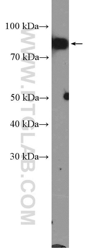 Western Blot (WB) analysis of K-562 cells using XRCC1 Polyclonal antibody (21468-1-AP)