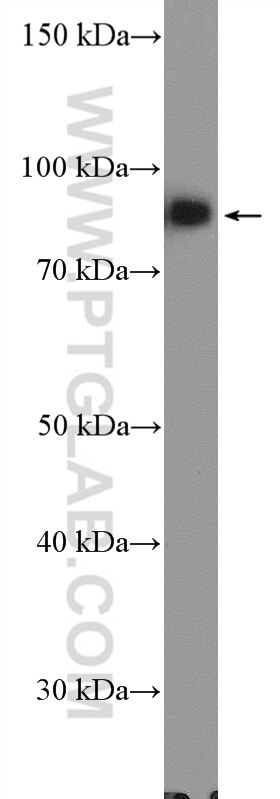 Western Blot (WB) analysis of Jurkat cells using XRCC1 Polyclonal antibody (21468-1-AP)