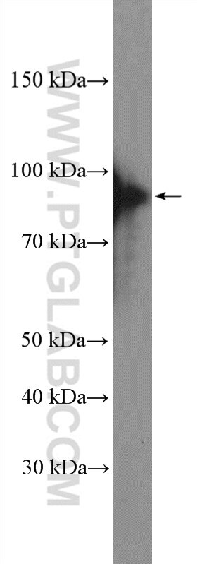 Western Blot (WB) analysis of HEK-293 cells using XRCC1 Polyclonal antibody (21468-1-AP)