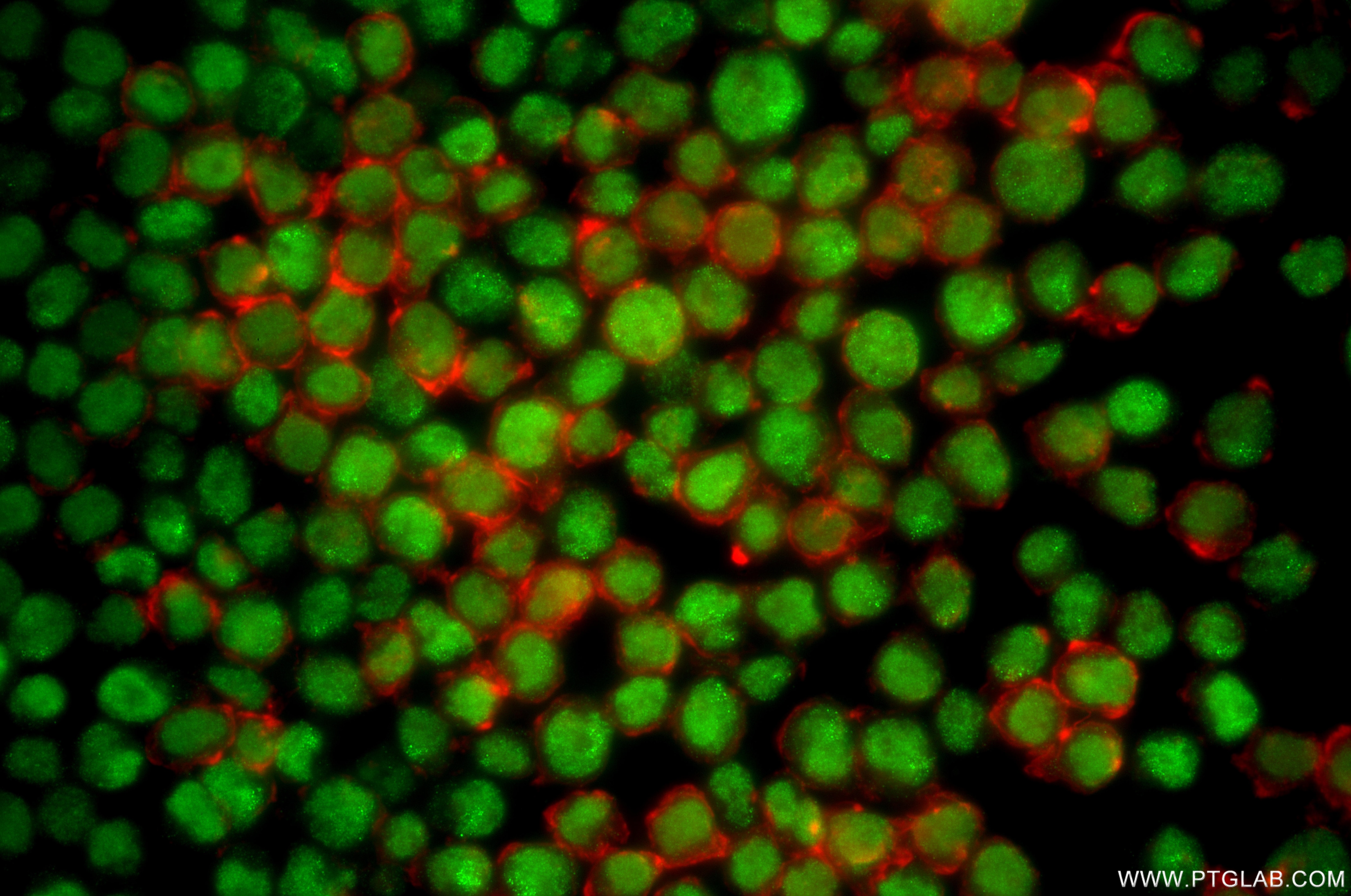IF Staining of Jurkat using 87251-1-RR Immunofluorescence (IF) / fluorescent staining of Jurkat cells using XRCC1 Recombinant monoclonal antibody (87251-1-RR)