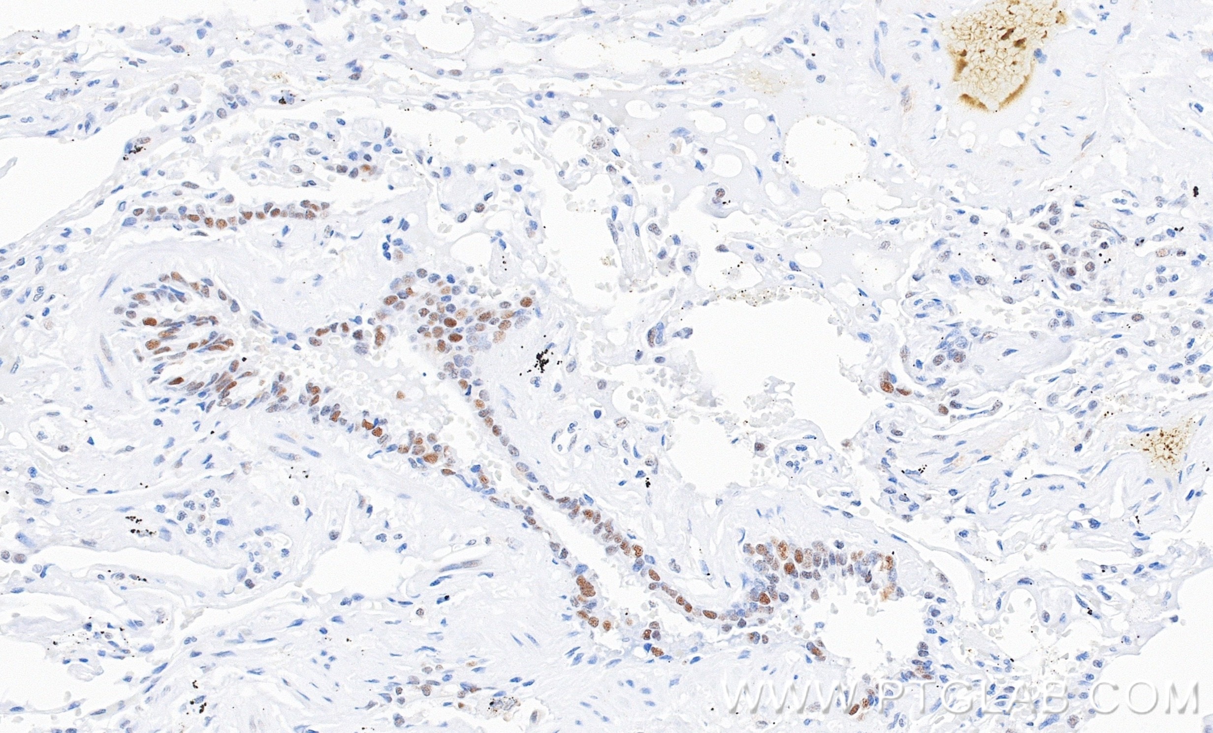 Immunohistochemistry (IHC) staining of human lung tissue using XRCC1 Recombinant monoclonal antibody (87251-1-RR)