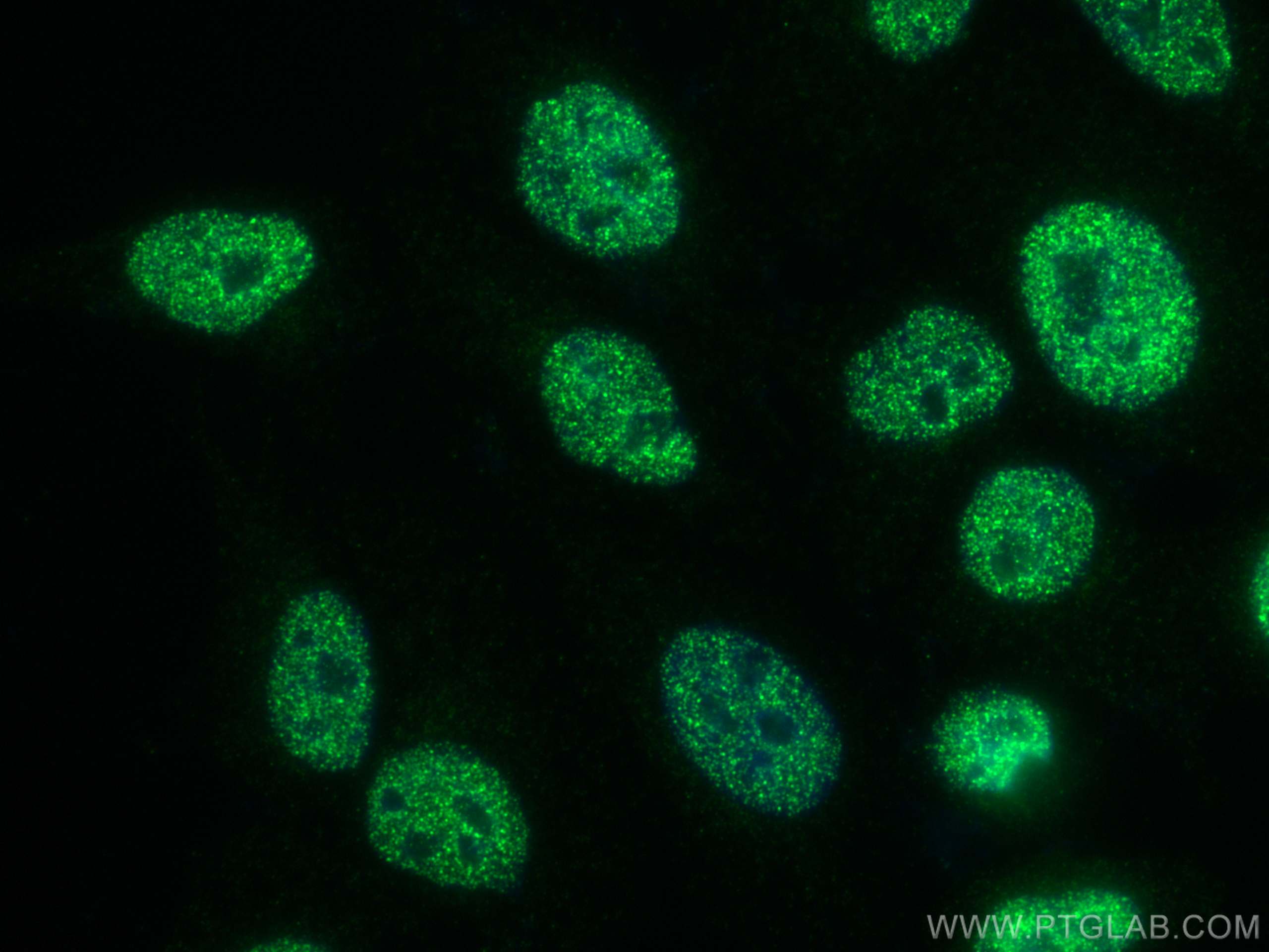 Immunofluorescence (IF) / fluorescent staining of HepG2 cells using XRCC2 Monoclonal antibody (66652-1-Ig)