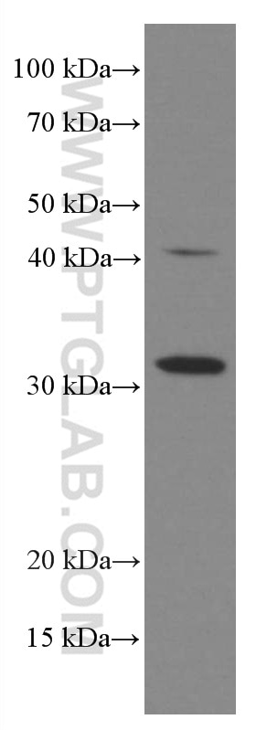XRCC2