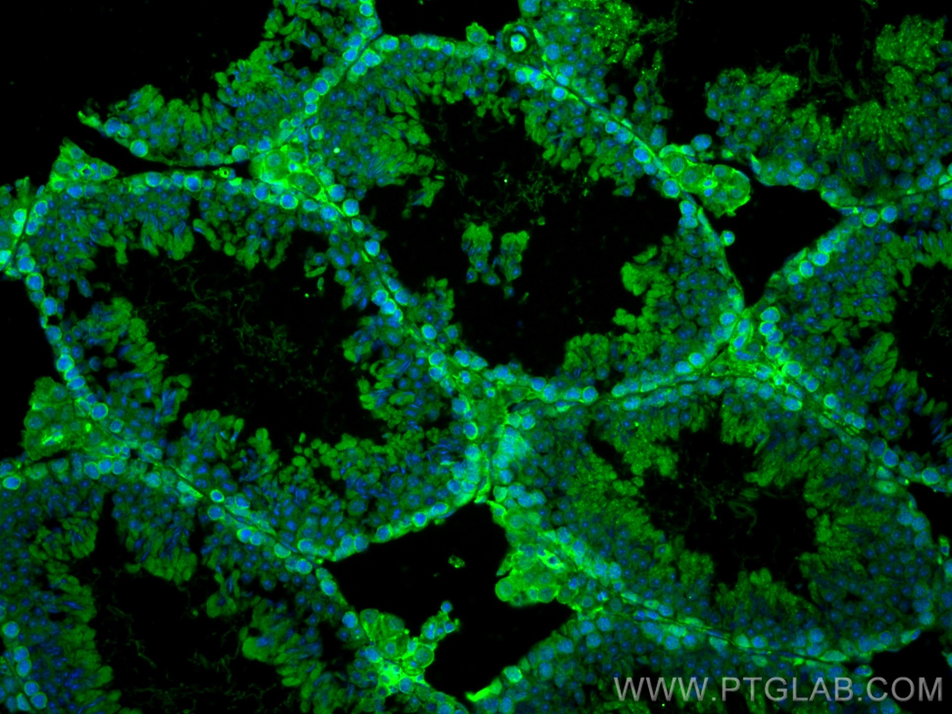 IF Staining of mouse testis using 67222-1-Ig