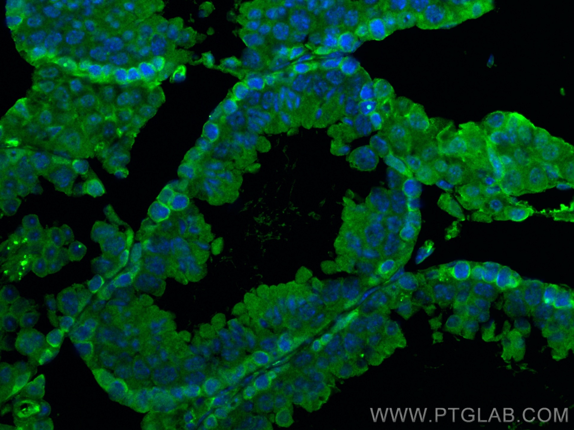 Immunofluorescence (IF) / fluorescent staining of mouse testis tissue using XRCC3 Monoclonal antibody (67222-1-Ig)
