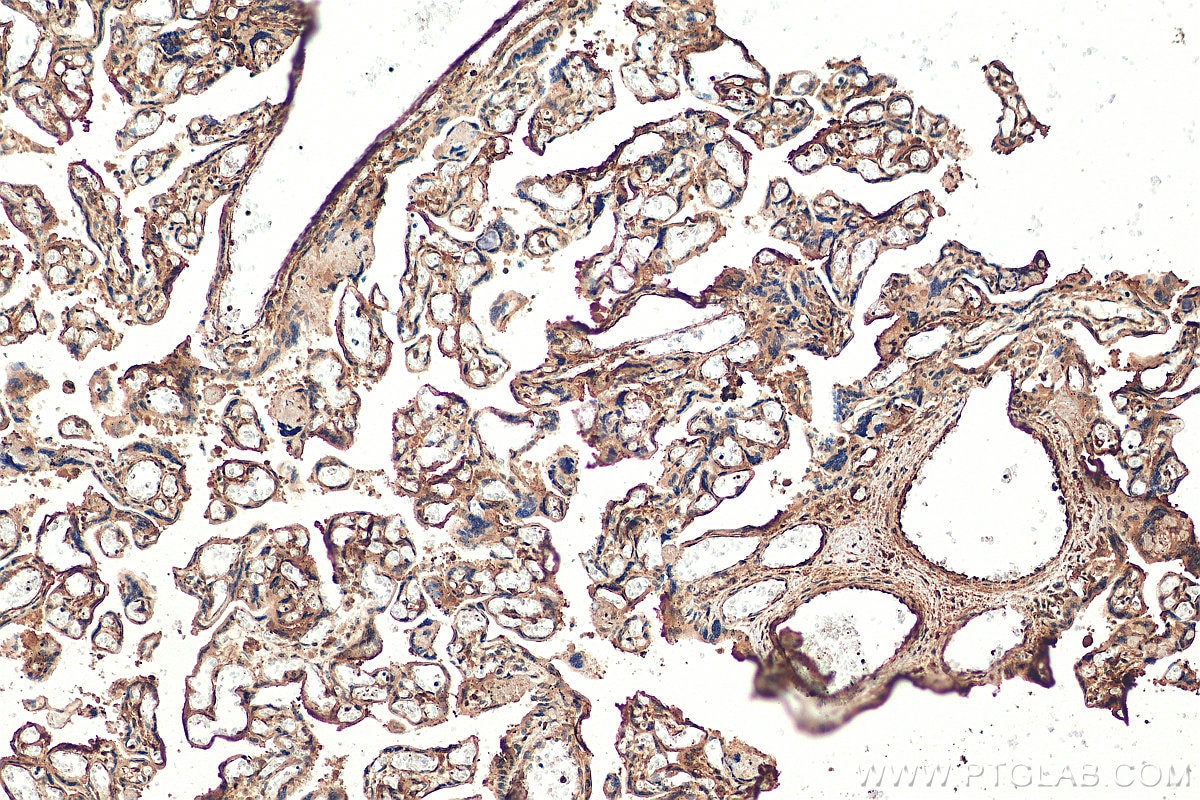Immunohistochemistry (IHC) staining of human placenta tissue using XRCC3 Monoclonal antibody (67222-1-Ig)