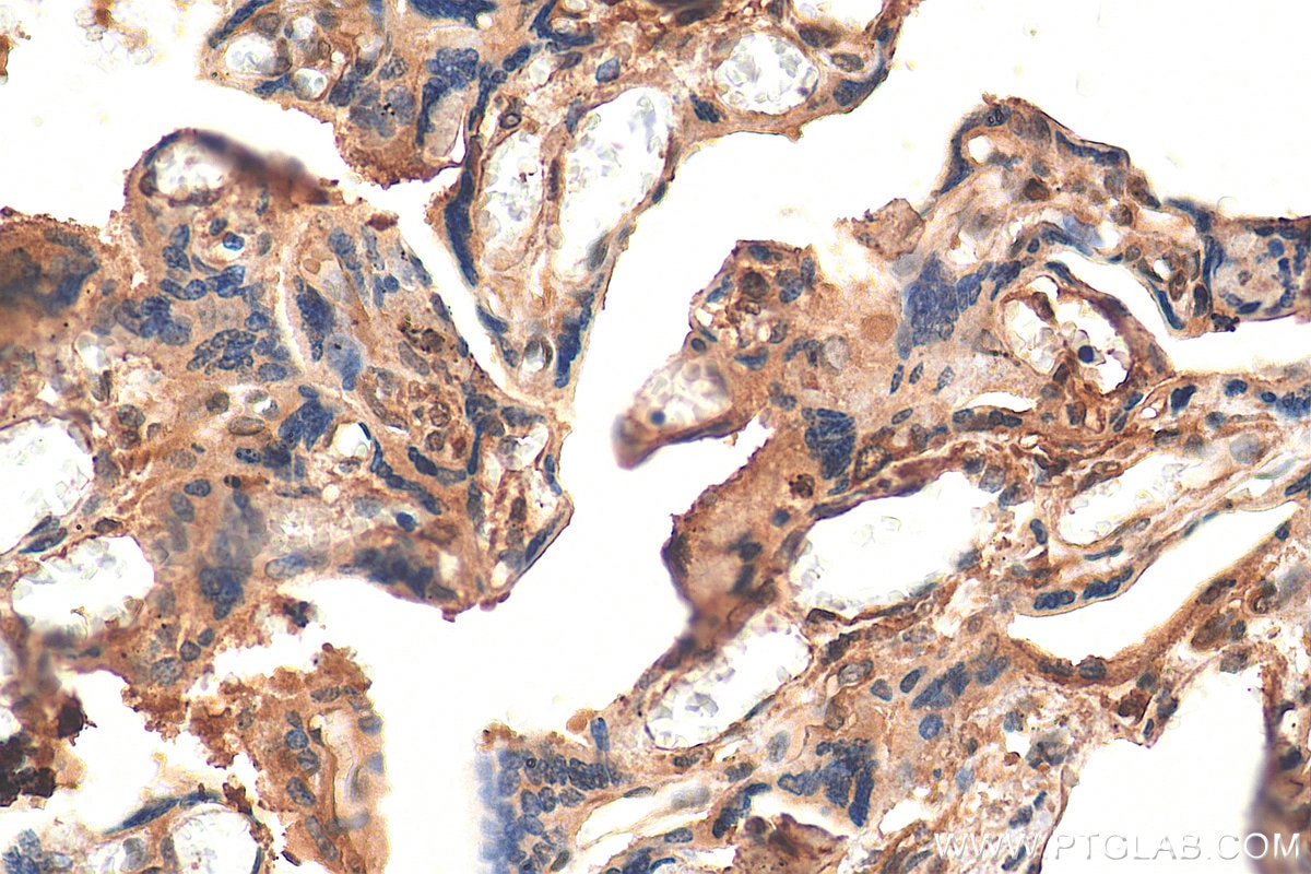 Immunohistochemistry (IHC) staining of human placenta tissue using XRCC3 Monoclonal antibody (67222-1-Ig)