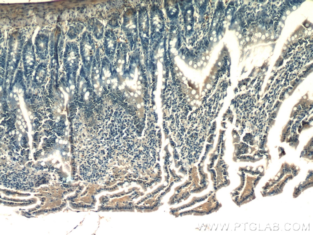 Immunohistochemistry (IHC) staining of rat small intestine tissue using XRCC4 Polyclonal antibody (15817-1-AP)