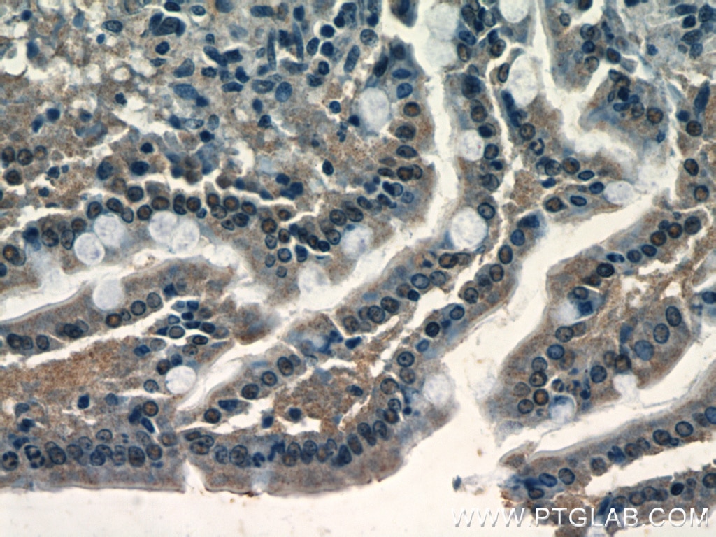 Immunohistochemistry (IHC) staining of rat small intestine tissue using XRCC4 Polyclonal antibody (15817-1-AP)