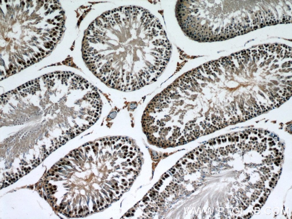 Immunohistochemistry (IHC) staining of rat testis tissue using XRCC4 Polyclonal antibody (15817-1-AP)