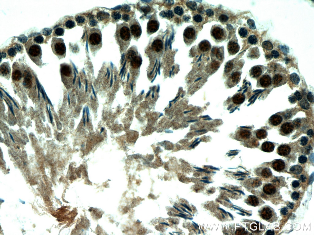 IHC staining of rat testis using 15817-1-AP