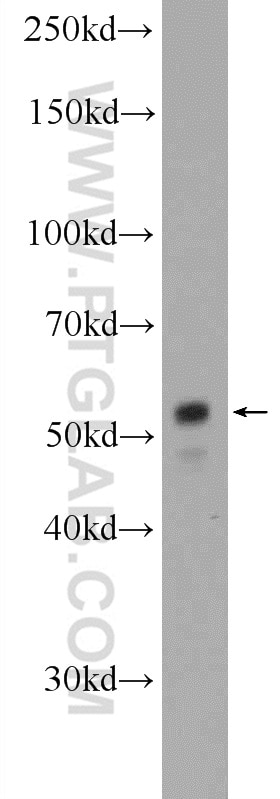 Western Blot (WB) analysis of HepG2 cells using XRCC4 Polyclonal antibody (15817-1-AP)
