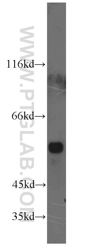 Western Blot (WB) analysis of COLO 320 cells using XRCC4 Polyclonal antibody (15817-1-AP)