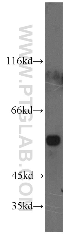 WB analysis of COLO 320 using 15817-1-AP