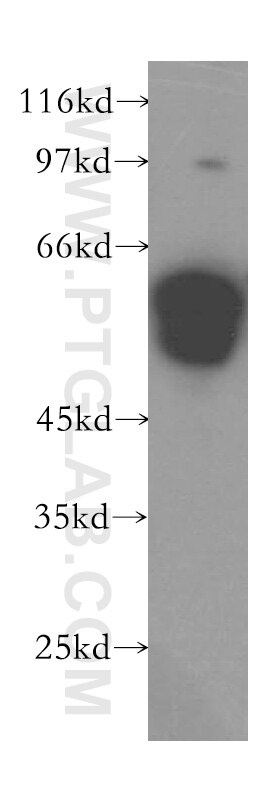 WB analysis of HepG2 using 15817-1-AP