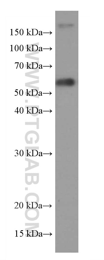 Western Blot (WB) analysis of COLO 320 cells using XRCC4 Monoclonal antibody (66621-1-Ig)