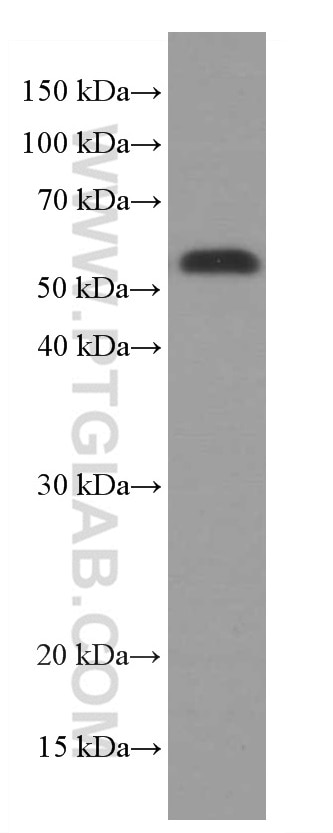 WB analysis of MCF-7 using 66621-1-Ig