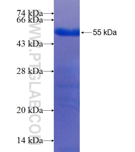 XRCC4 fusion protein Ag8807 SDS-PAGE
