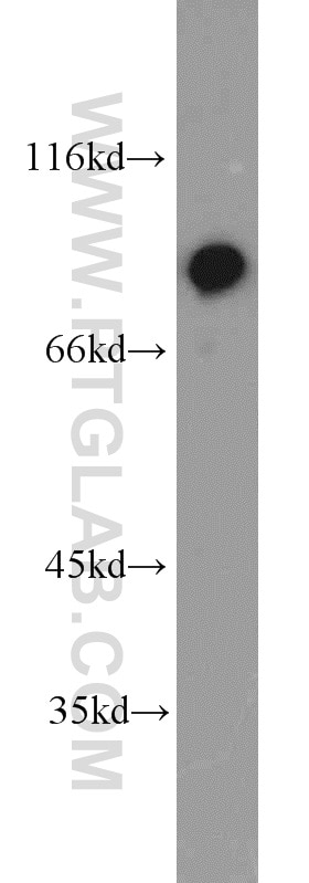 Western Blot (WB) analysis of A431 cells using XRCC5/Ku80 Polyclonal antibody (16389-1-AP)