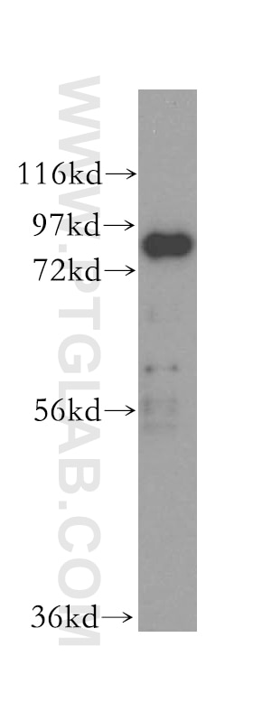 Western Blot (WB) analysis of human liver tissue using XRCC5/Ku80 Polyclonal antibody (16389-1-AP)
