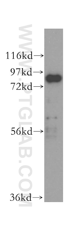 WB analysis of human liver using 16389-1-AP