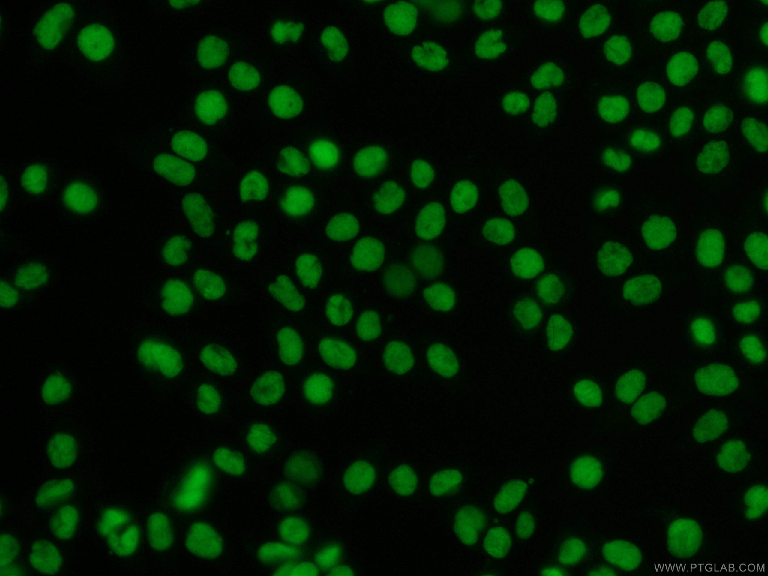 Immunofluorescence (IF) / fluorescent staining of HeLa cells using CoraLite®488-conjugated XRCC5 Monoclonal antibody (CL488-66546)