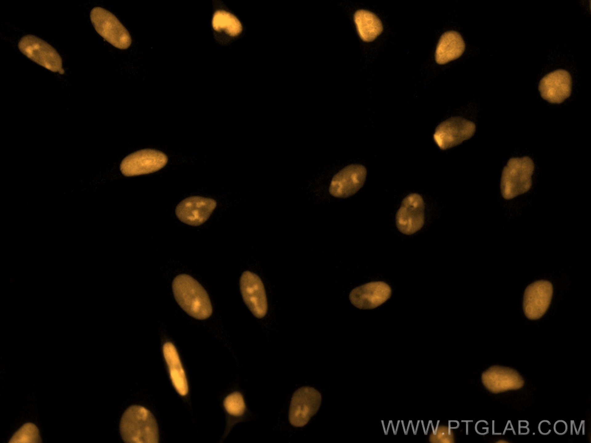 Immunofluorescence (IF) / fluorescent staining of HeLa cells using CoraLite®555-conjugated XRCC5 Monoclonal antibody (CL555-66546)