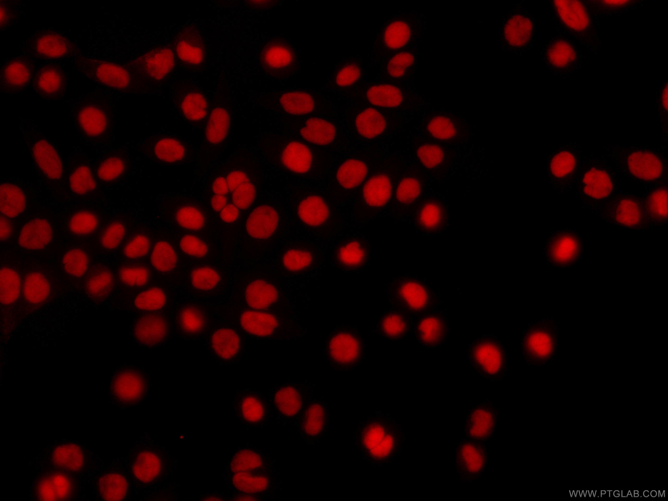 Immunofluorescence (IF) / fluorescent staining of HeLa cells using CoraLite®594-conjugated XRCC5 Monoclonal antibody (CL594-66546)