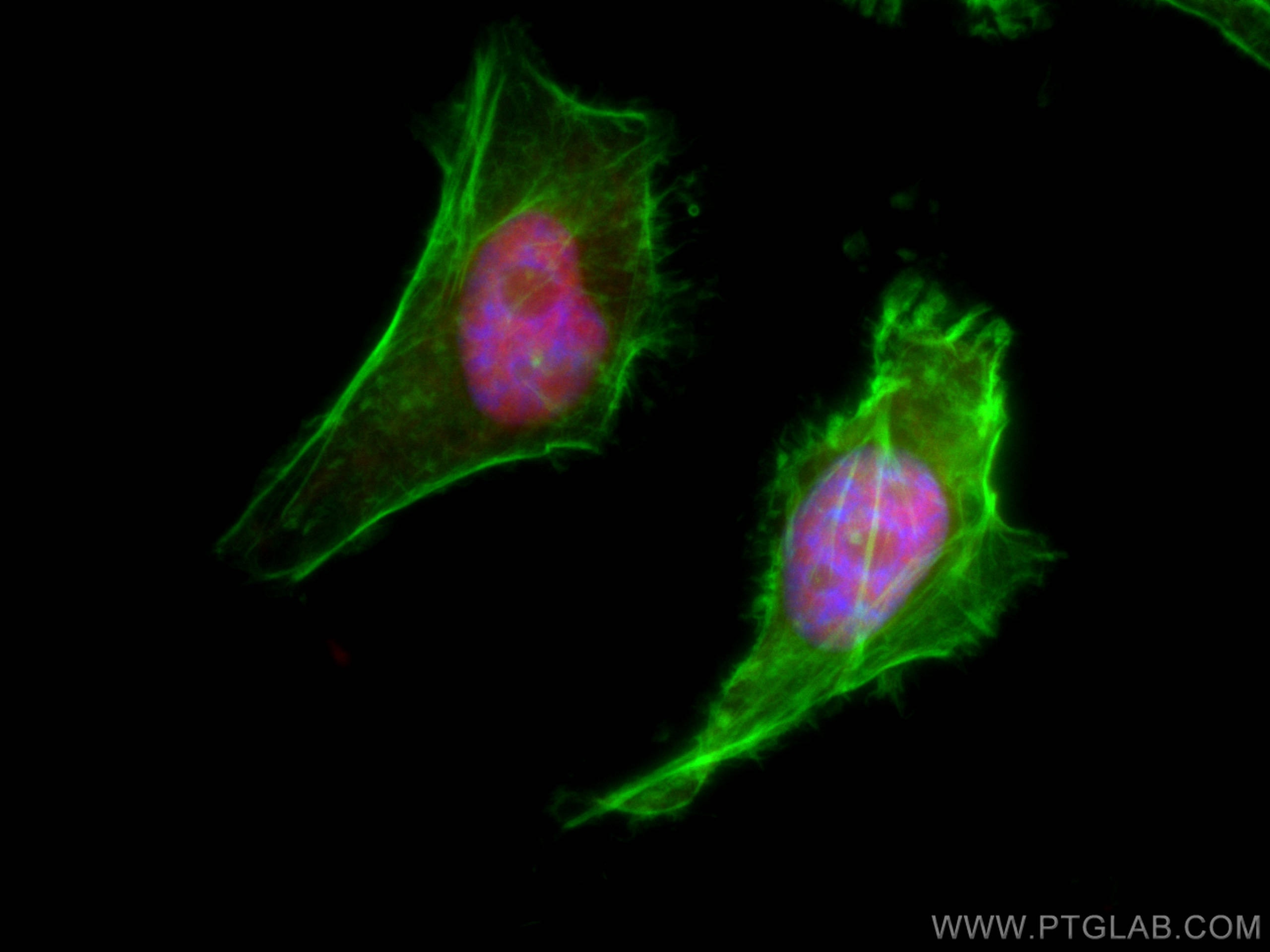 Immunofluorescence (IF) / fluorescent staining of HeLa cells using CoraLite®594-conjugated XRCC5 Monoclonal antibody (CL594-66546)