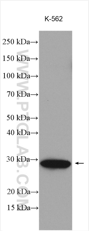 WB analysis using 16076-1-AP