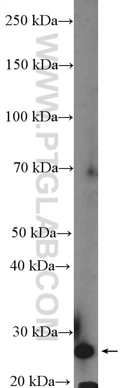 XRCC6BP1