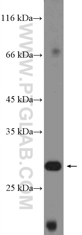 WB analysis of HepG2 using 16076-1-AP