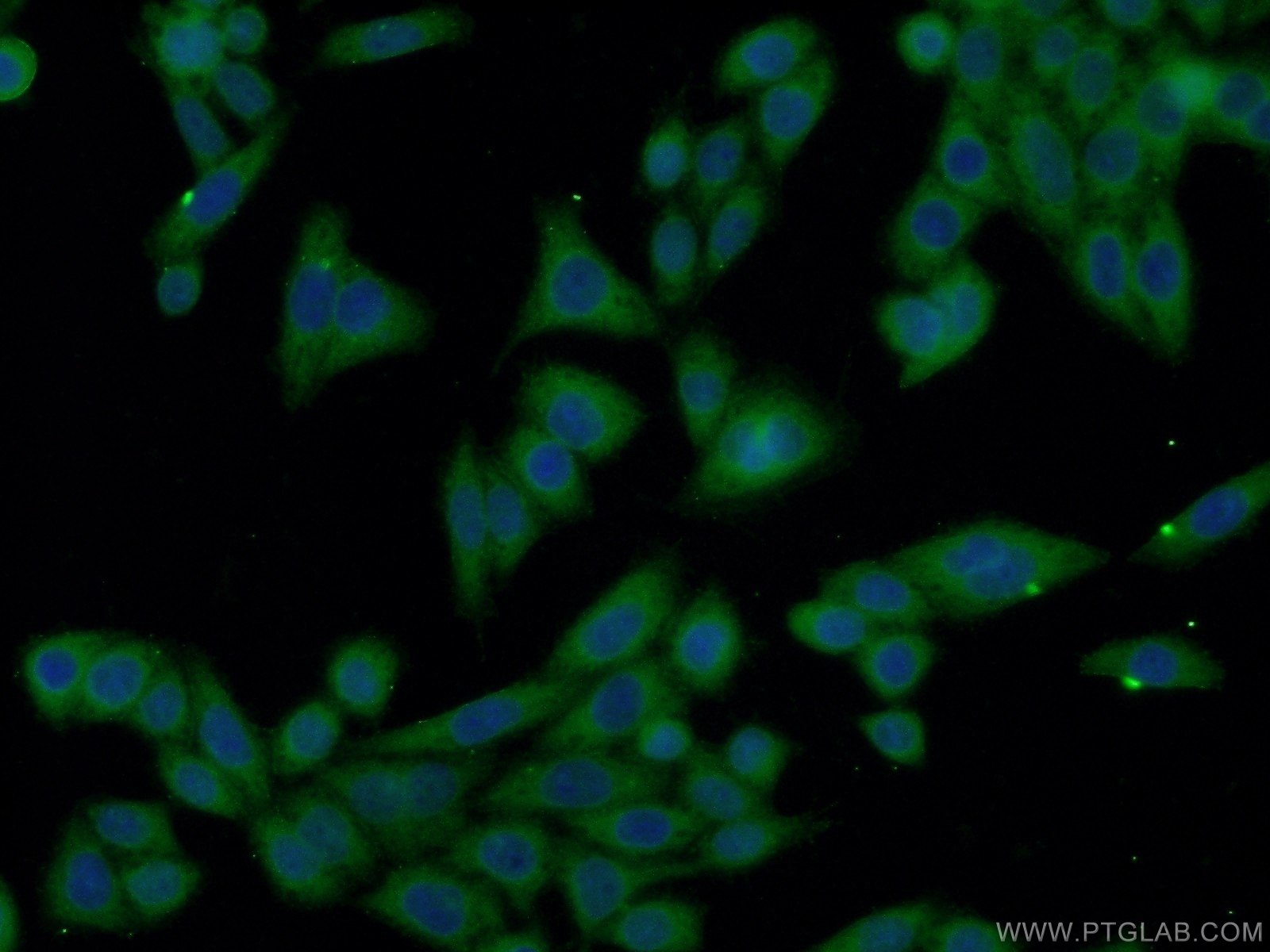 Immunofluorescence (IF) / fluorescent staining of HeLa cells using XRN1 Polyclonal antibody (23108-1-AP)