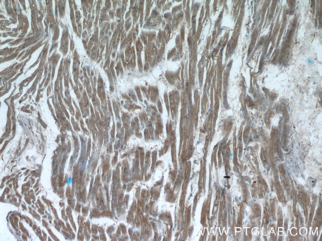 Immunohistochemistry (IHC) staining of human heart tissue using XRN1 Polyclonal antibody (23108-1-AP)