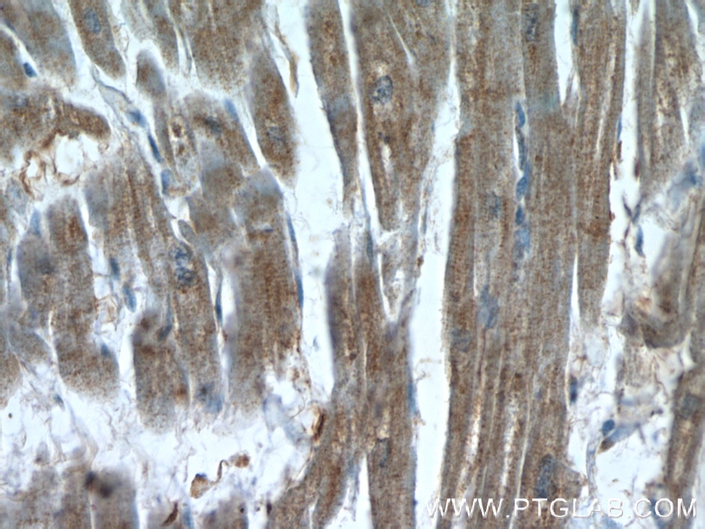 Immunohistochemistry (IHC) staining of human heart tissue using XRN1 Polyclonal antibody (23108-1-AP)