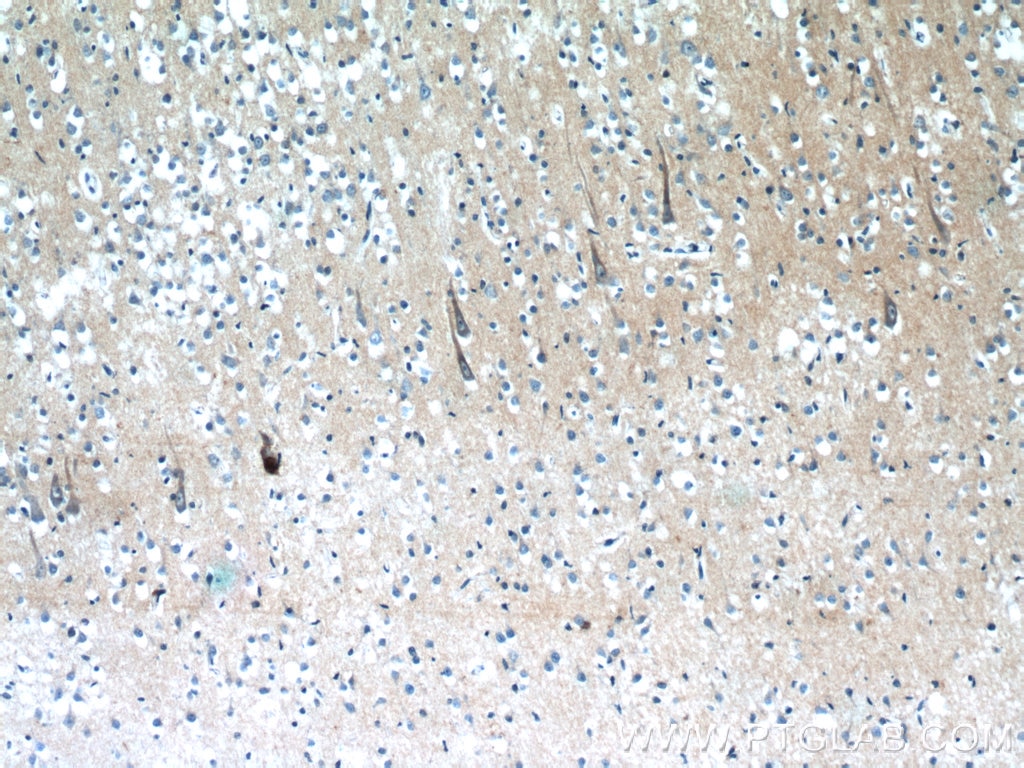 Immunohistochemistry (IHC) staining of human brain tissue using XRN1 Polyclonal antibody (23108-1-AP)