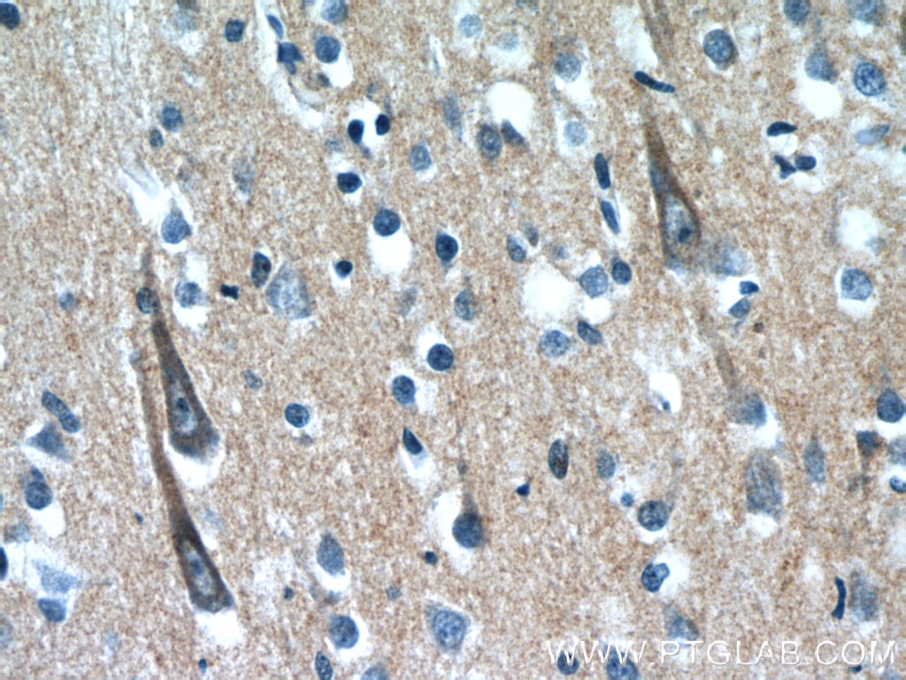 Immunohistochemistry (IHC) staining of human brain tissue using XRN1 Polyclonal antibody (23108-1-AP)