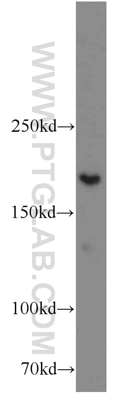 Western Blot (WB) analysis of HeLa cells using XRN1 Polyclonal antibody (23108-1-AP)