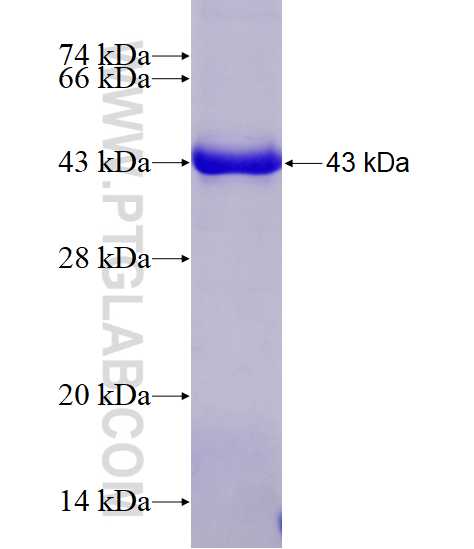 XRN1 fusion protein Ag19398 SDS-PAGE
