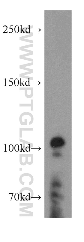 Western Blot (WB) analysis of COLO 320 cells using XRN2 Polyclonal antibody (11267-1-AP)