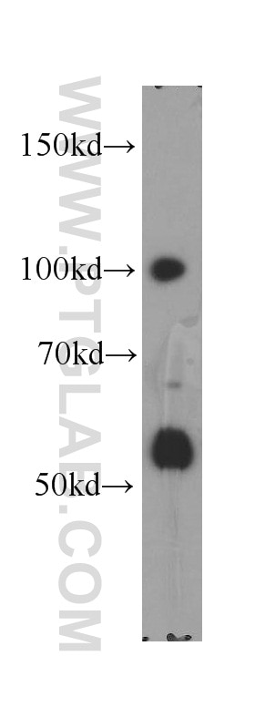 Western Blot (WB) analysis of HEK-293 cells using XRN2 Polyclonal antibody (11267-1-AP)