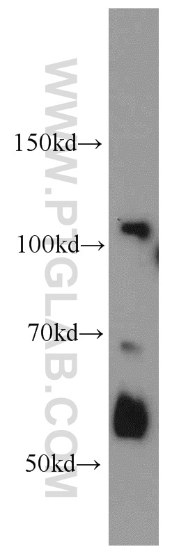Western Blot (WB) analysis of HeLa cells using XRN2 Polyclonal antibody (11267-1-AP)