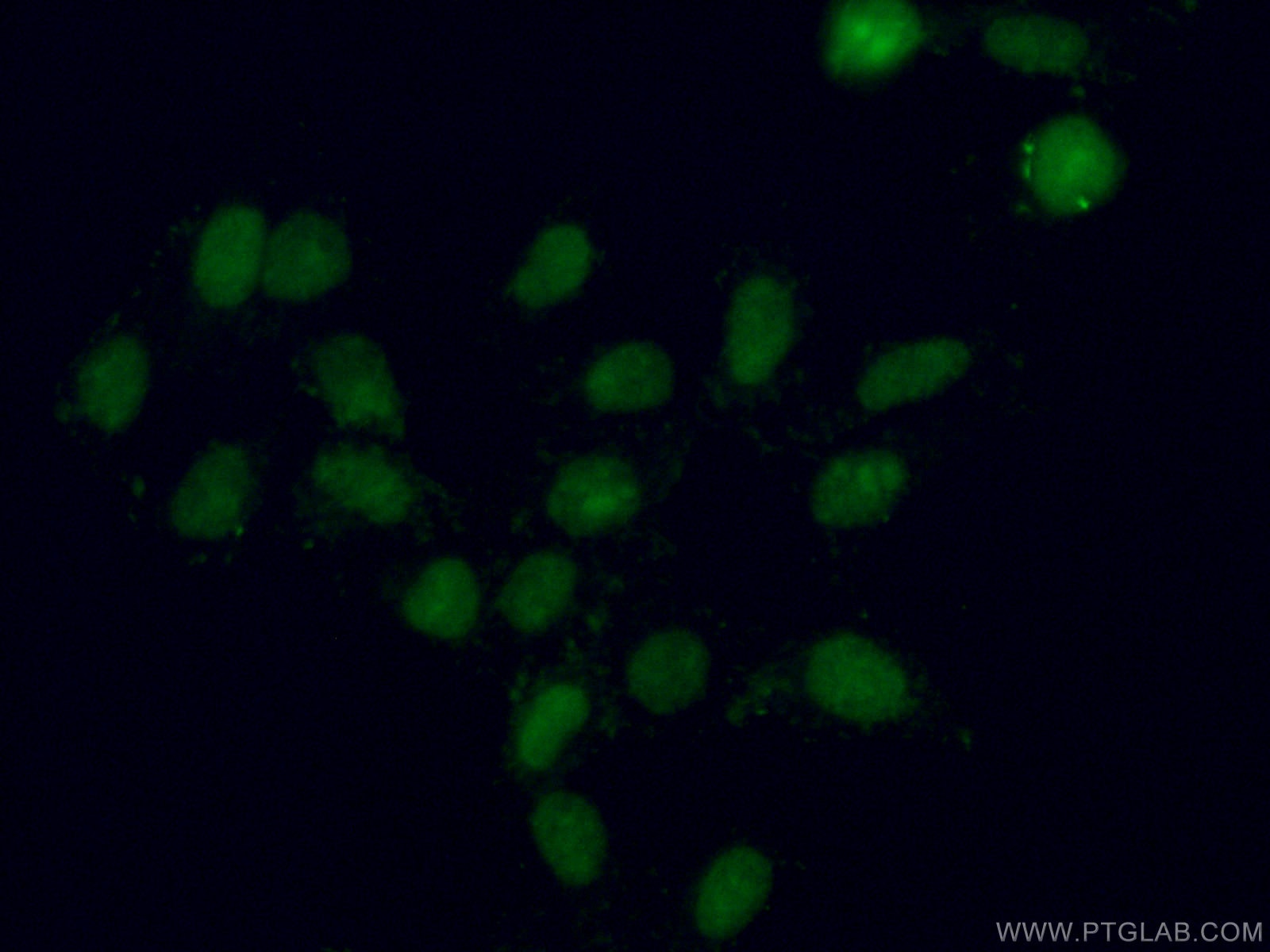 Immunofluorescence (IF) / fluorescent staining of HepG2 cells using XRN2 Monoclonal antibody (66852-1-Ig)