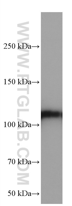 Western Blot (WB) analysis of COLO 320 cells using XRN2 Monoclonal antibody (66852-1-Ig)