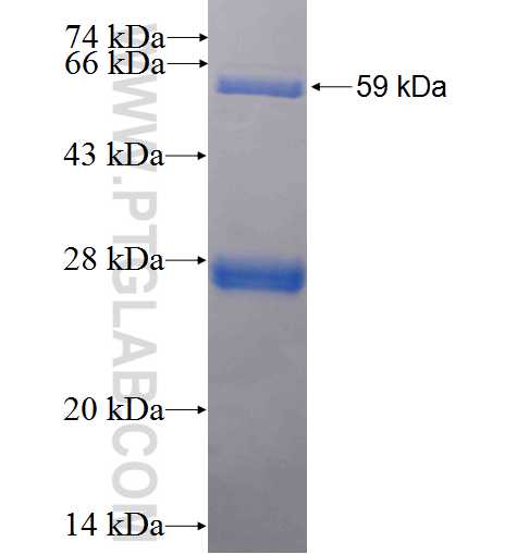XRN2 fusion protein Ag1788 SDS-PAGE