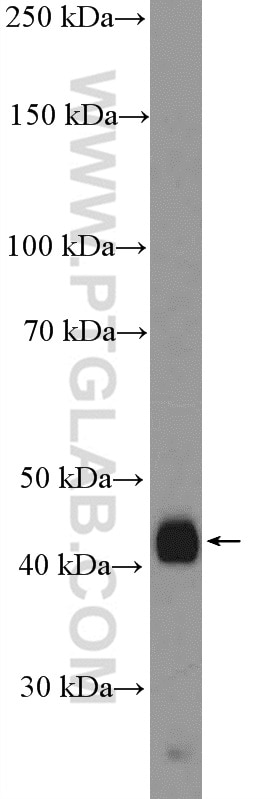 Western Blot (WB) analysis of A431 cells using XYLB Polyclonal antibody (26541-1-AP)