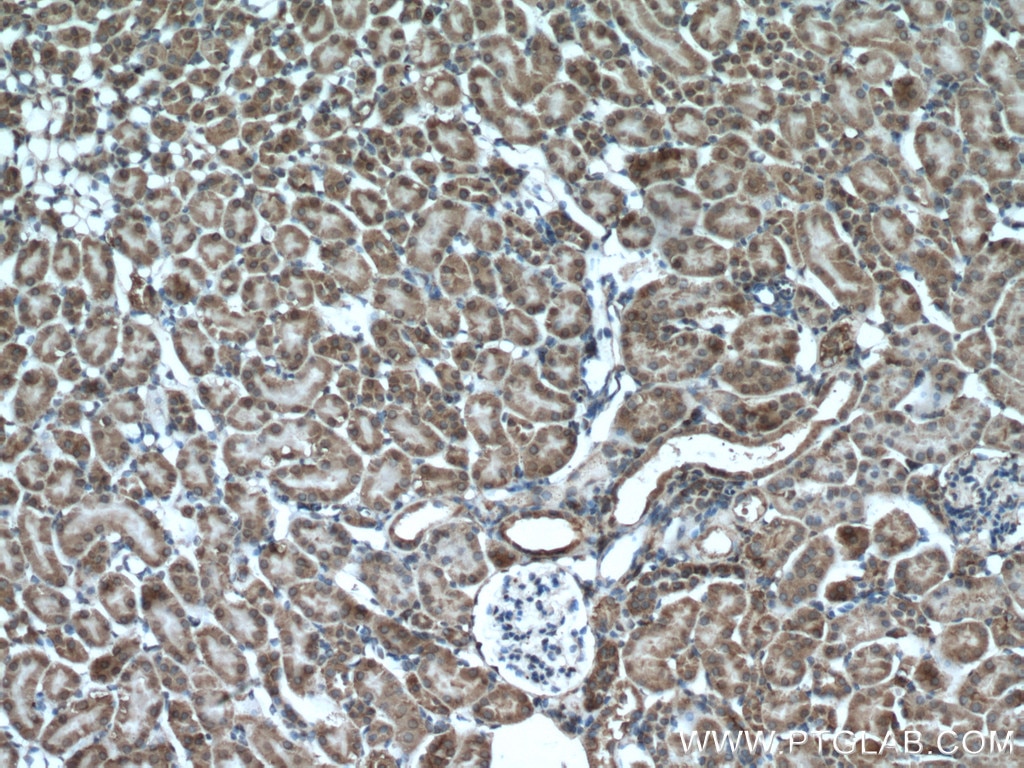 Immunohistochemistry (IHC) staining of mouse kidney tissue using XYLT1 Polyclonal antibody (55061-1-AP)