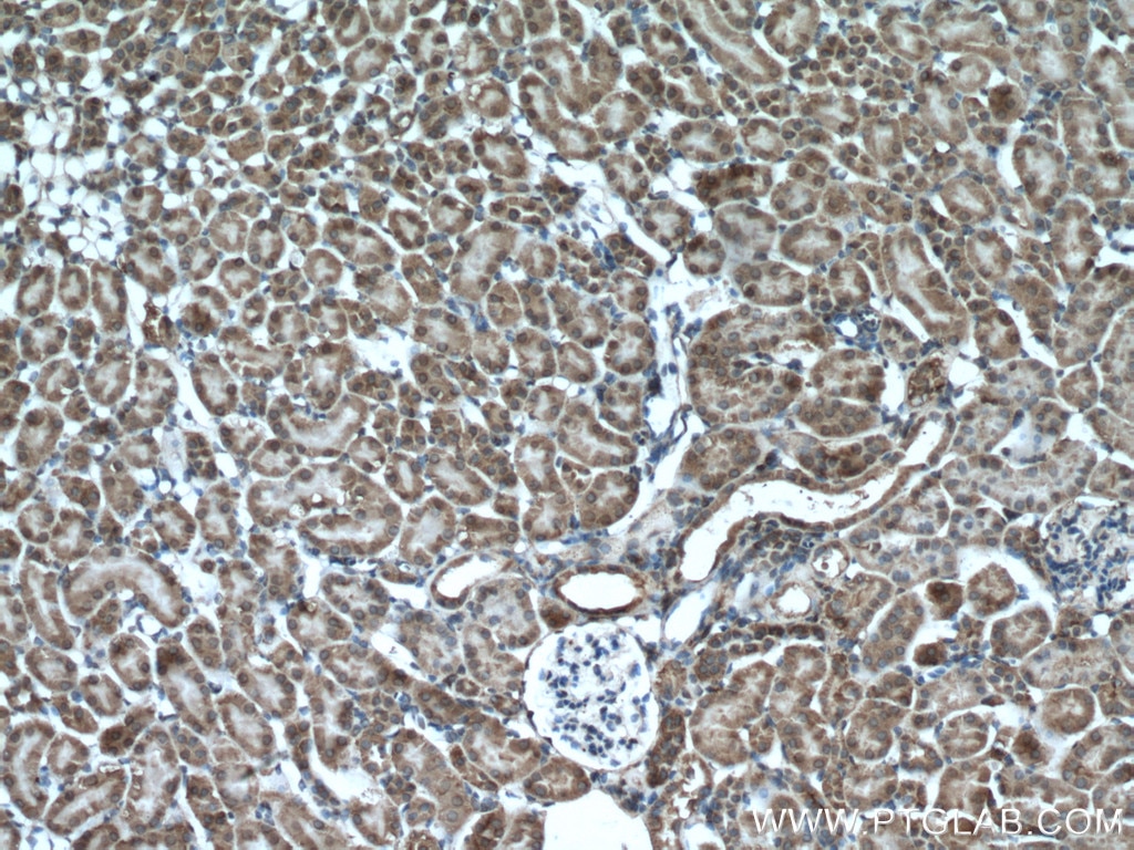 Immunohistochemistry (IHC) staining of mouse kidney tissue using XYLT1 Polyclonal antibody (55061-1-AP)